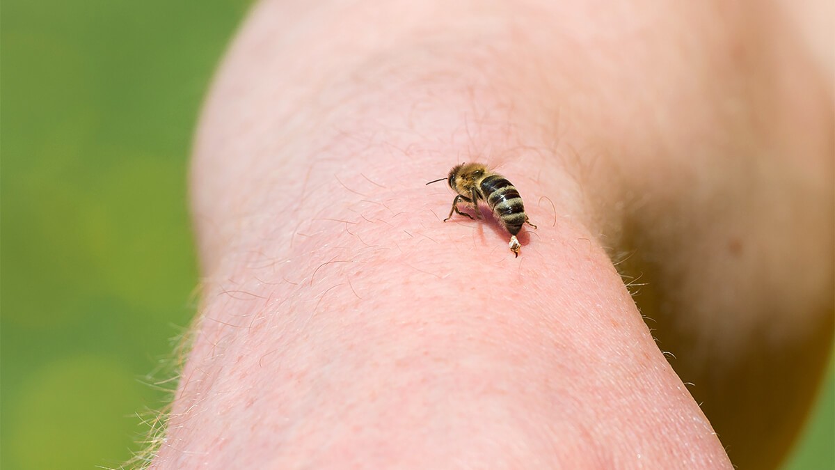 Treating A Bee Sting Tips By Fantastic Pest Control Australia